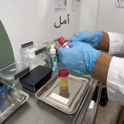 DIABETE -urgence-GLYCEMIE CGM -BORDJ EL KIFFAN